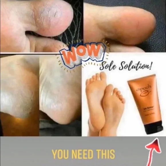 - (2) TWO Epoch NuSkin Sole Solution foot treatment